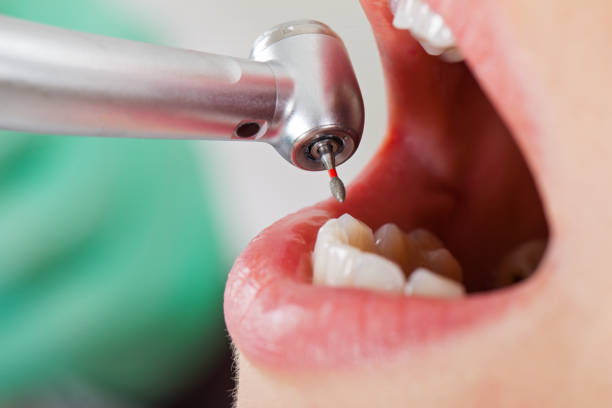 Best Pediatric Emergency Dentist in Nashville, GA
